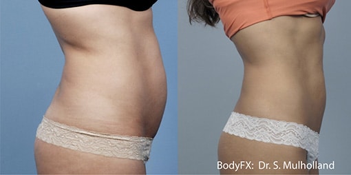 bodyfx-4 bodyfx