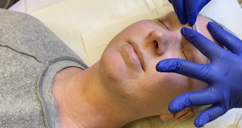 dermaplaning-poster dermaplaning poster