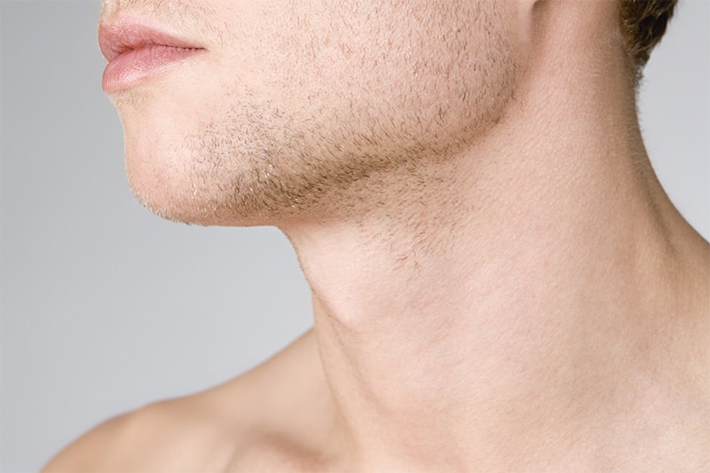 Neck Lift Options for Men