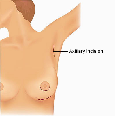 axillary graphic