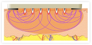 original_radio-frequency_diagram