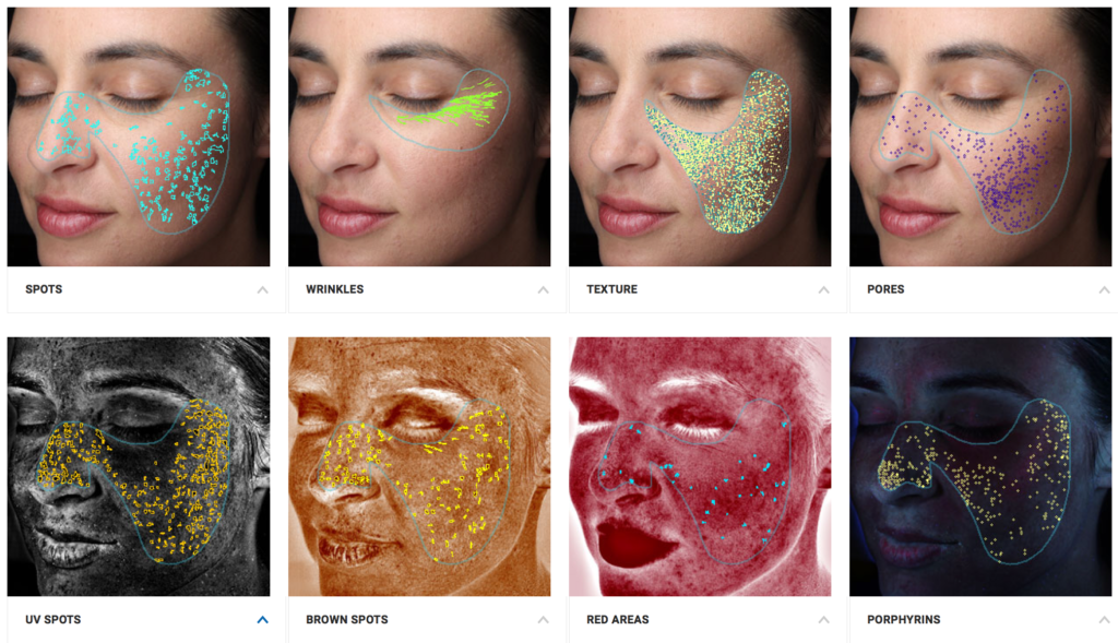 Visia Map of Skin Damage by Type