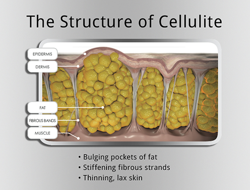 Cellulaze graphic