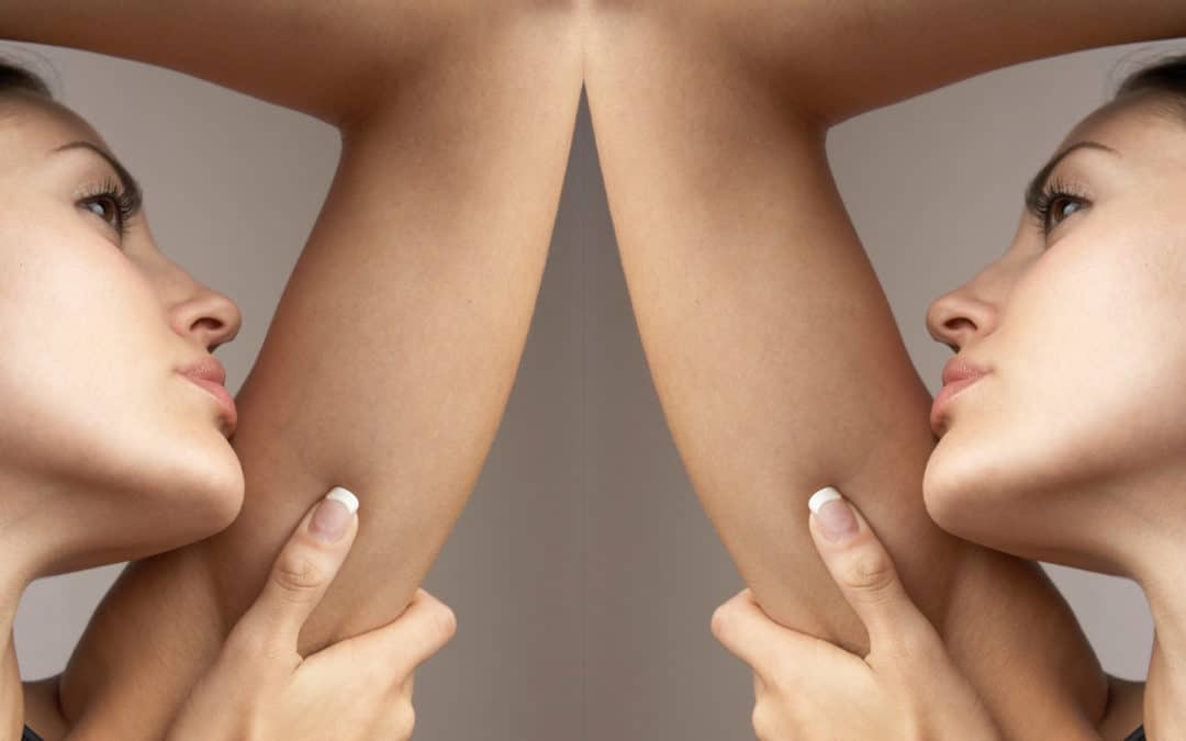 Beautiful Arms Are Possible with Laser Liposuction