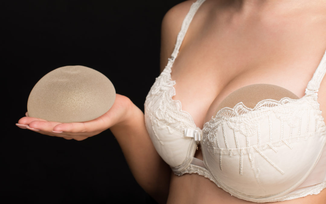 When to Replace Breast Implants