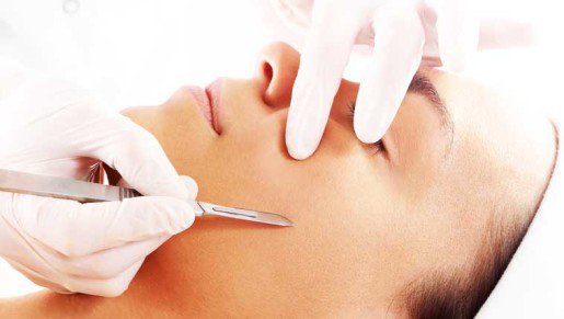 what is dermaplaning