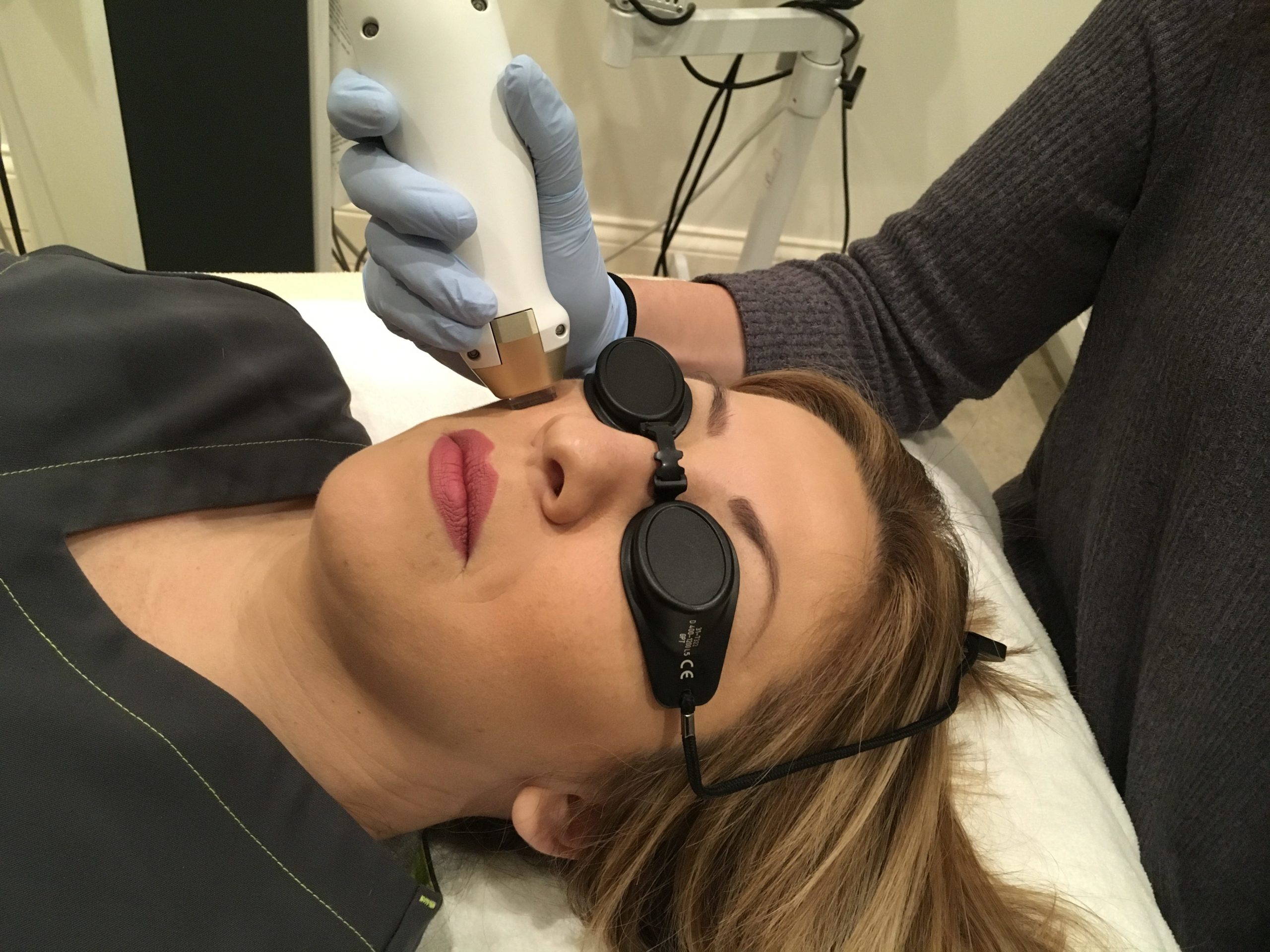 Microbeam Treatment at Whole Beauty® Institute