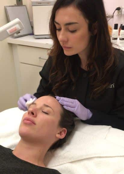 skin peel chicago