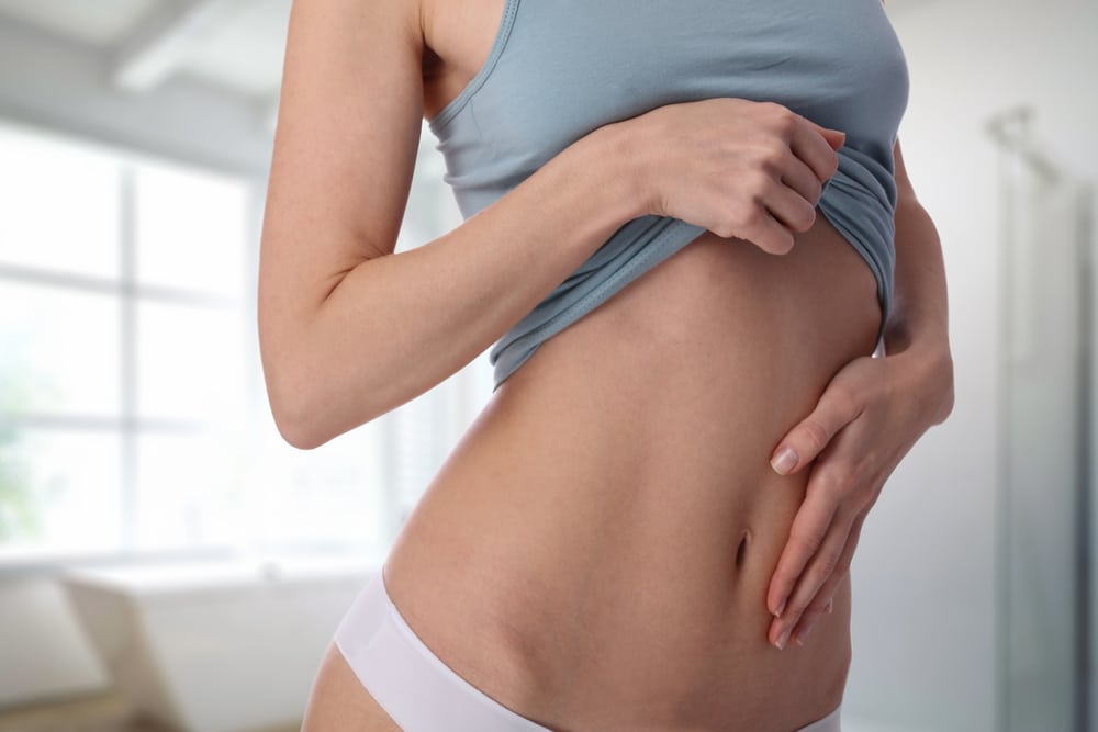When is BodyTite Better Than Liposuction?