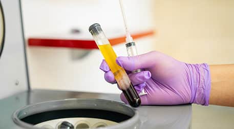 The Benefits of PRP – Platelet Rich Plasma