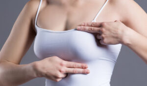 Capsular Contracture After Augmentation with Implants