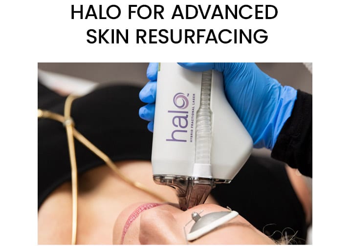 HALO for Advanced Skin Resurfacing