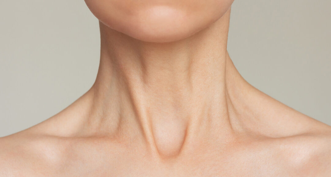 Do Neck Lift Patients Always Have to Get a Facelift, Too?