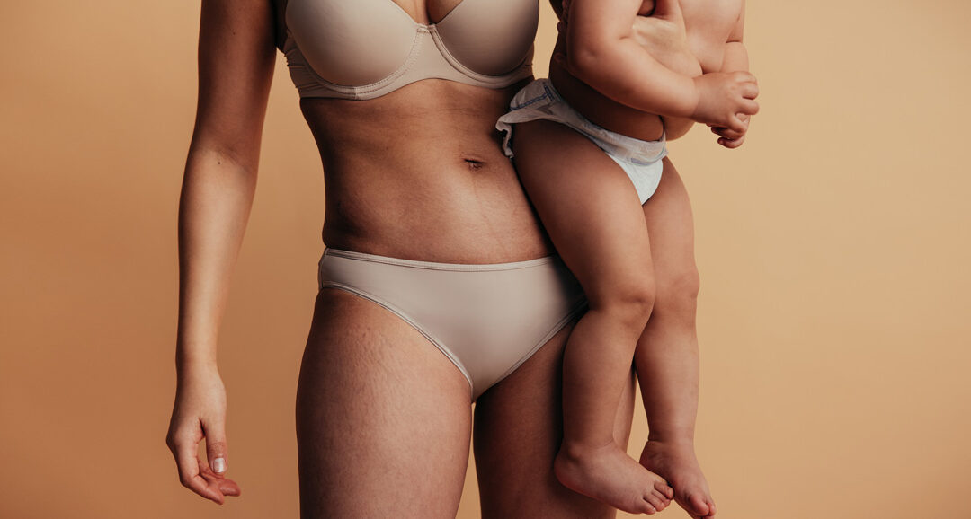 Mommy Makeover Myths: What’s Fact and What’s Fiction?