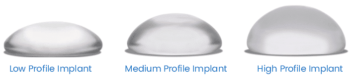 Breast Implant Profiles - Low to High