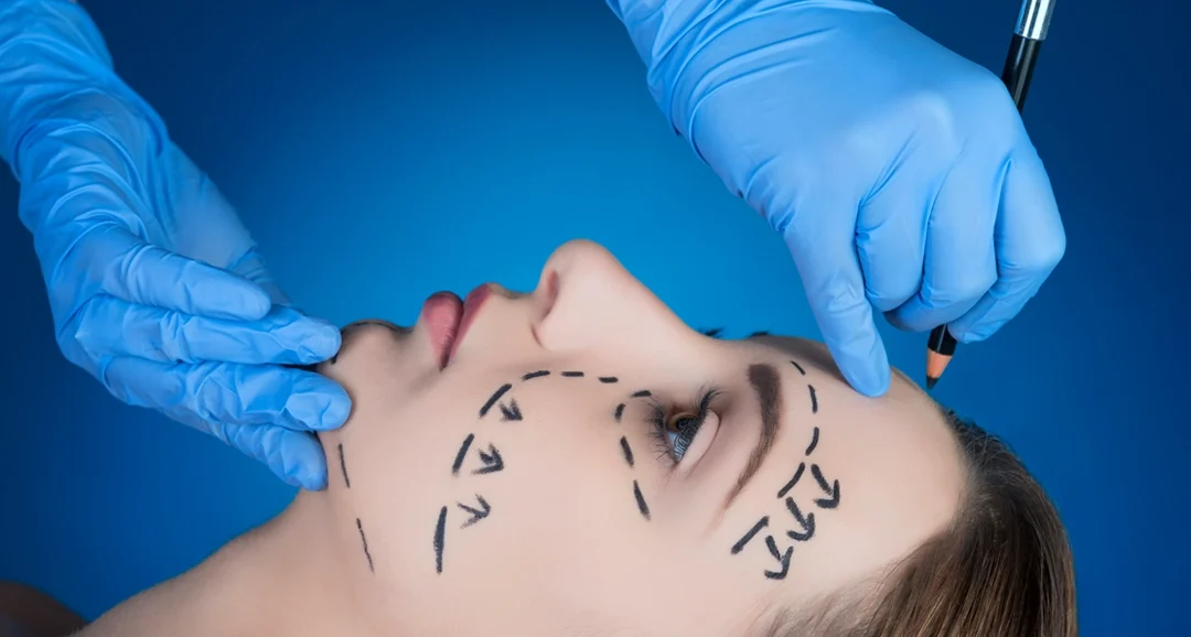 Mini Facelift vs. Full Facelift: Which is Better for You?
